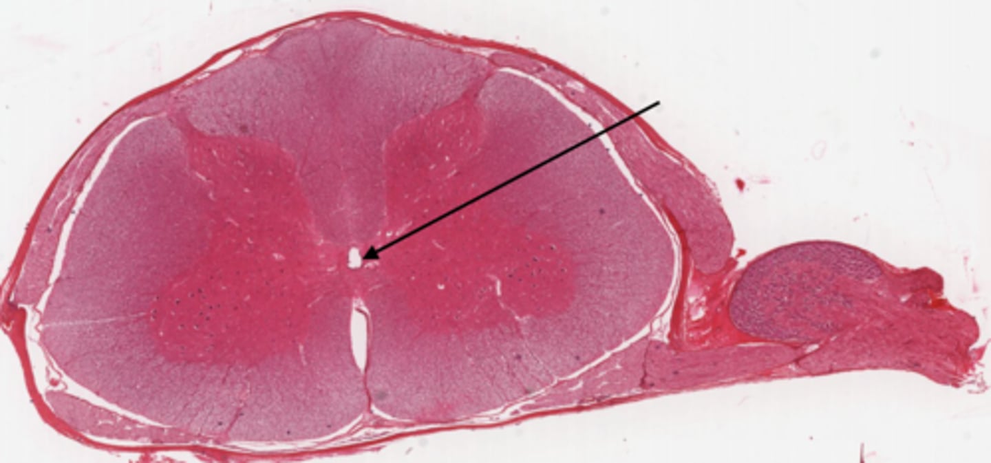 <p>Identify the part of the spinal cord</p>