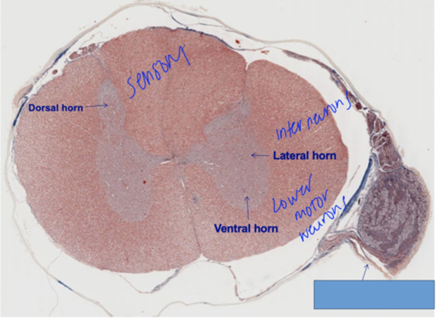 <p>Identify the following structure in PNS</p>