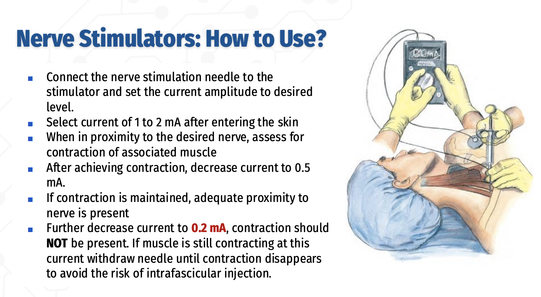 <p>How is a peripheral nerve stimulator used to safely locate a nerve during regional anesthesia?</p>