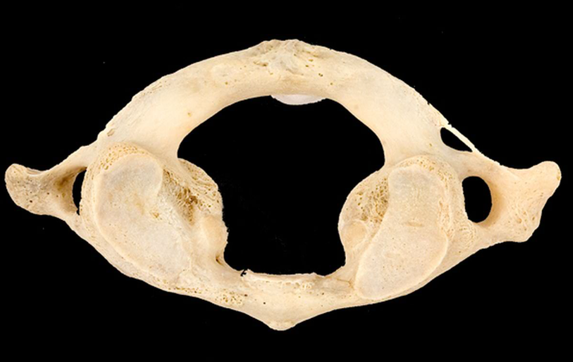 <p>Which bone is this?</p><p>(Superior view).</p>