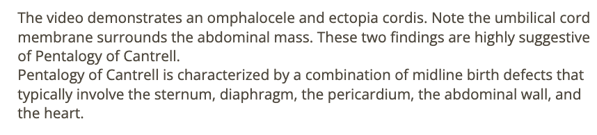 <p>a) omphalocele + ectopia cordis</p>