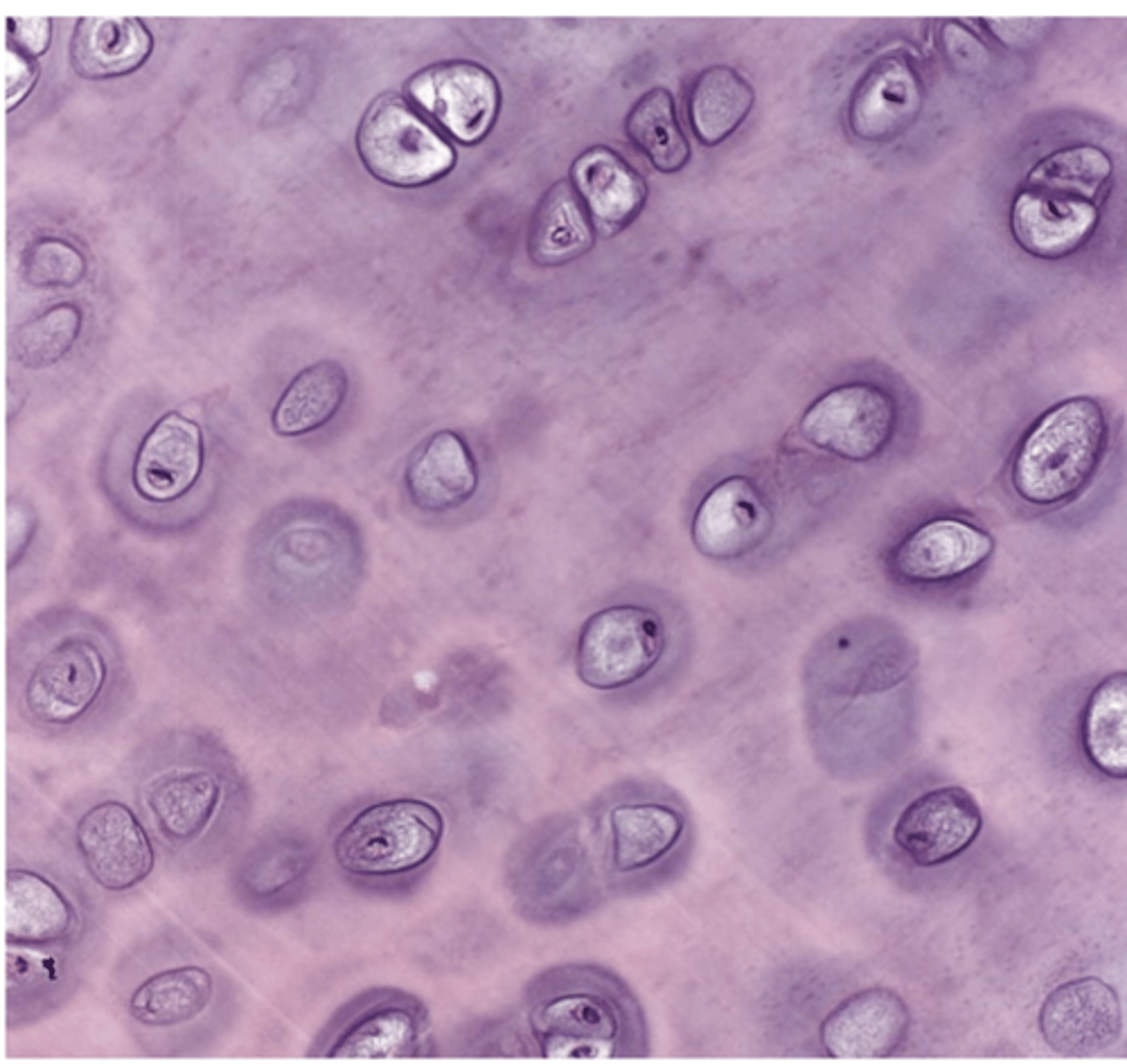 <p>What does "hyalos" mean in hyaline cartilage?</p>