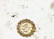 <ol><li><p>Identify structure.</p></li><li><p>What crystal is this structure closely similar with?</p></li></ol><p></p>