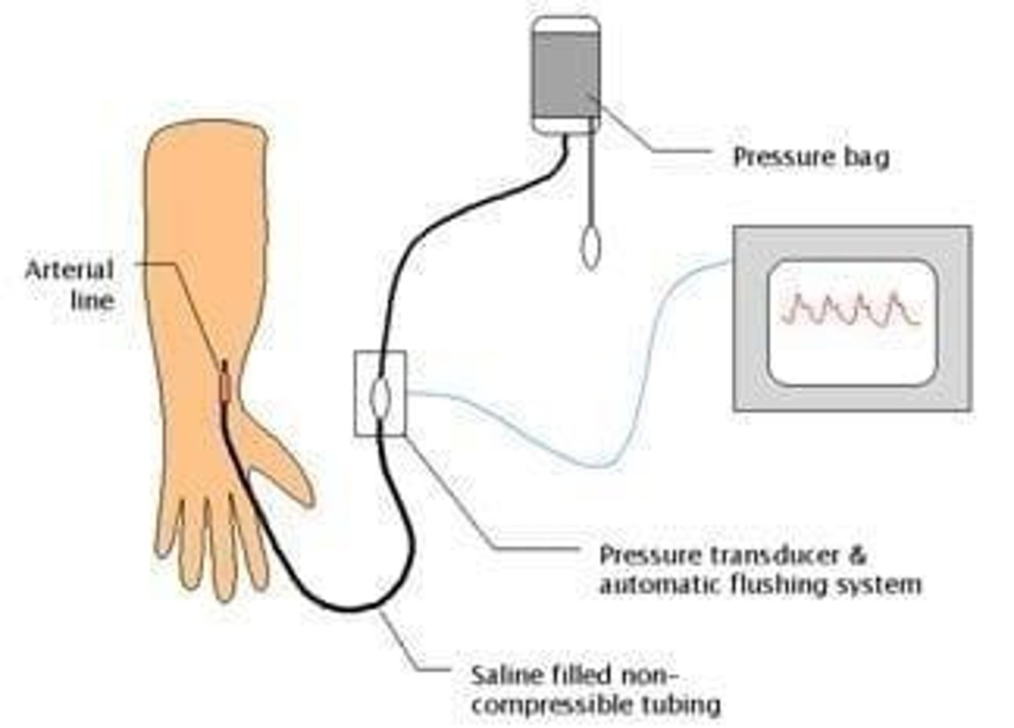 <p>Used for acute measurement of blood pressure or regular blood monitoring in critically ill and/or hemodynamically unstable patients.</p>