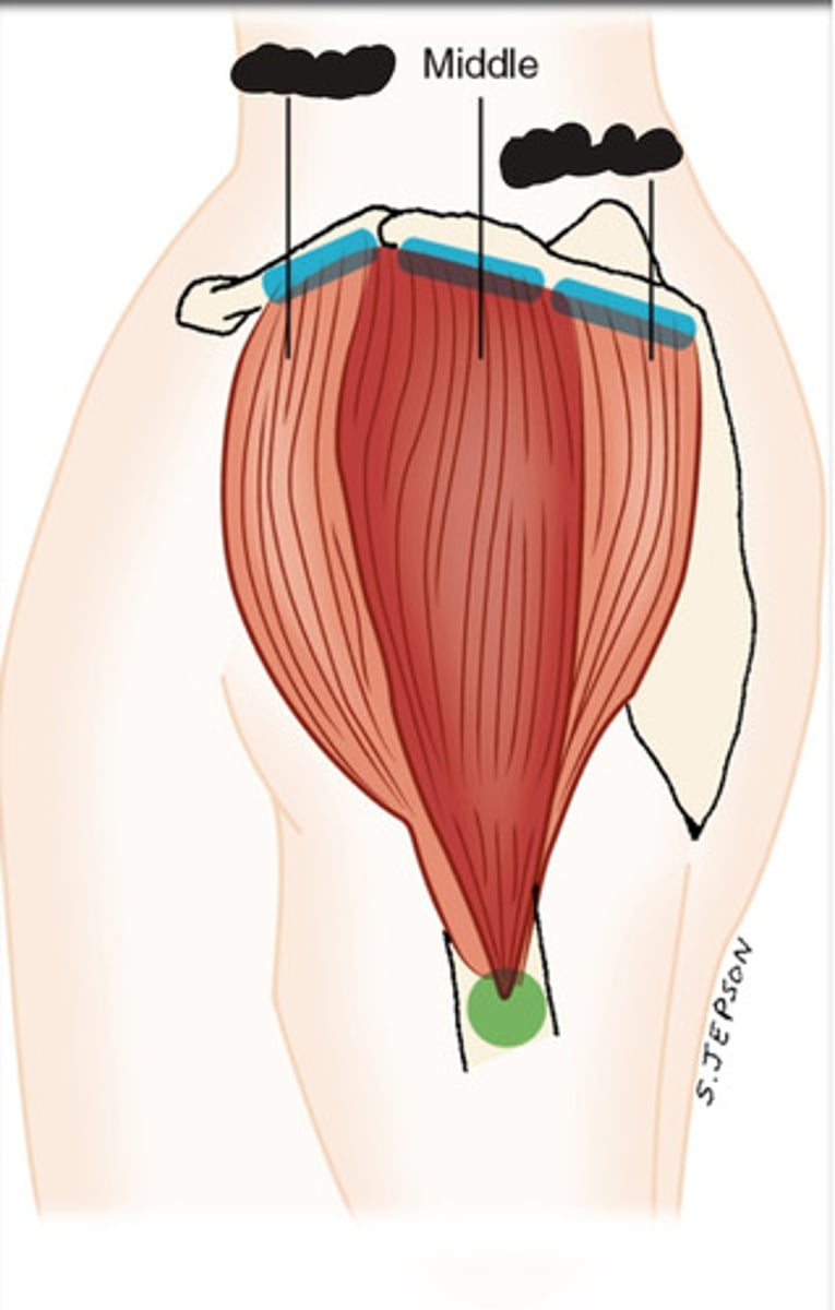 <p>What muscle is this?</p>