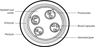 <p>What metacestode type is this?</p>