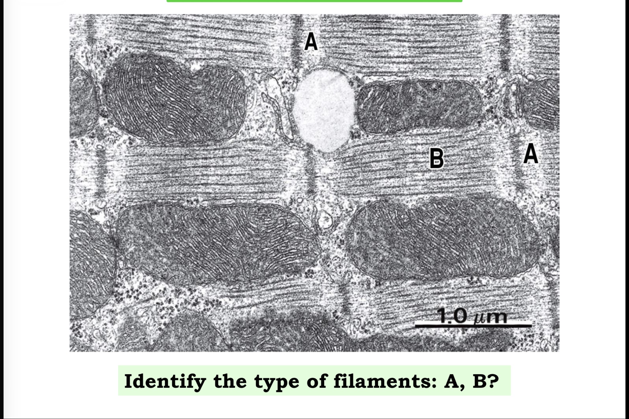 <p>Answer the questions in these following pictures </p>