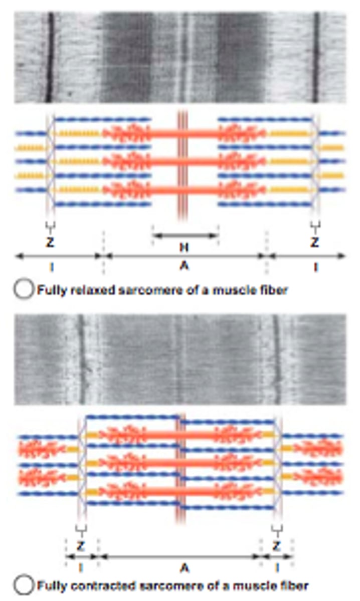 <p>The structures of the myocyte that perform contraction</p>