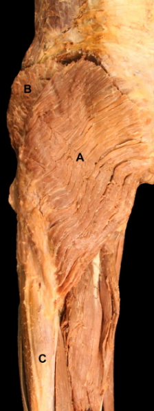 <p>A</p>
