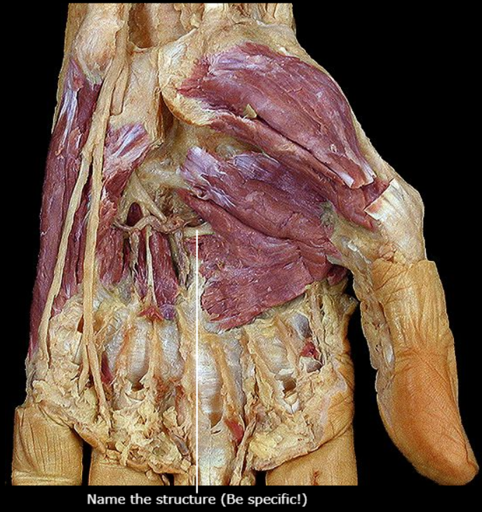 <p>What nerve is this</p>