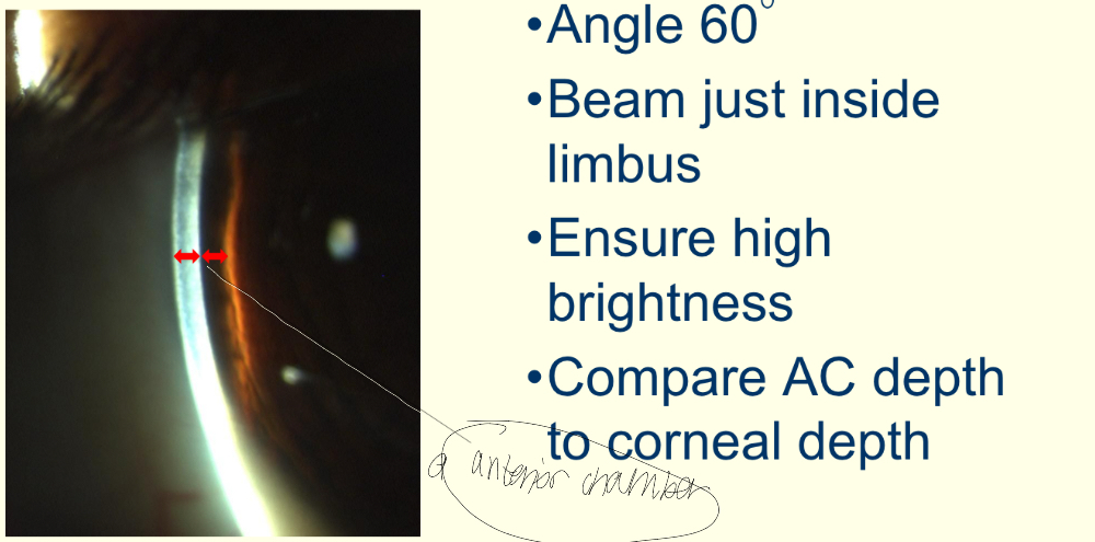<p>Describe this method and what structures can be seen</p>