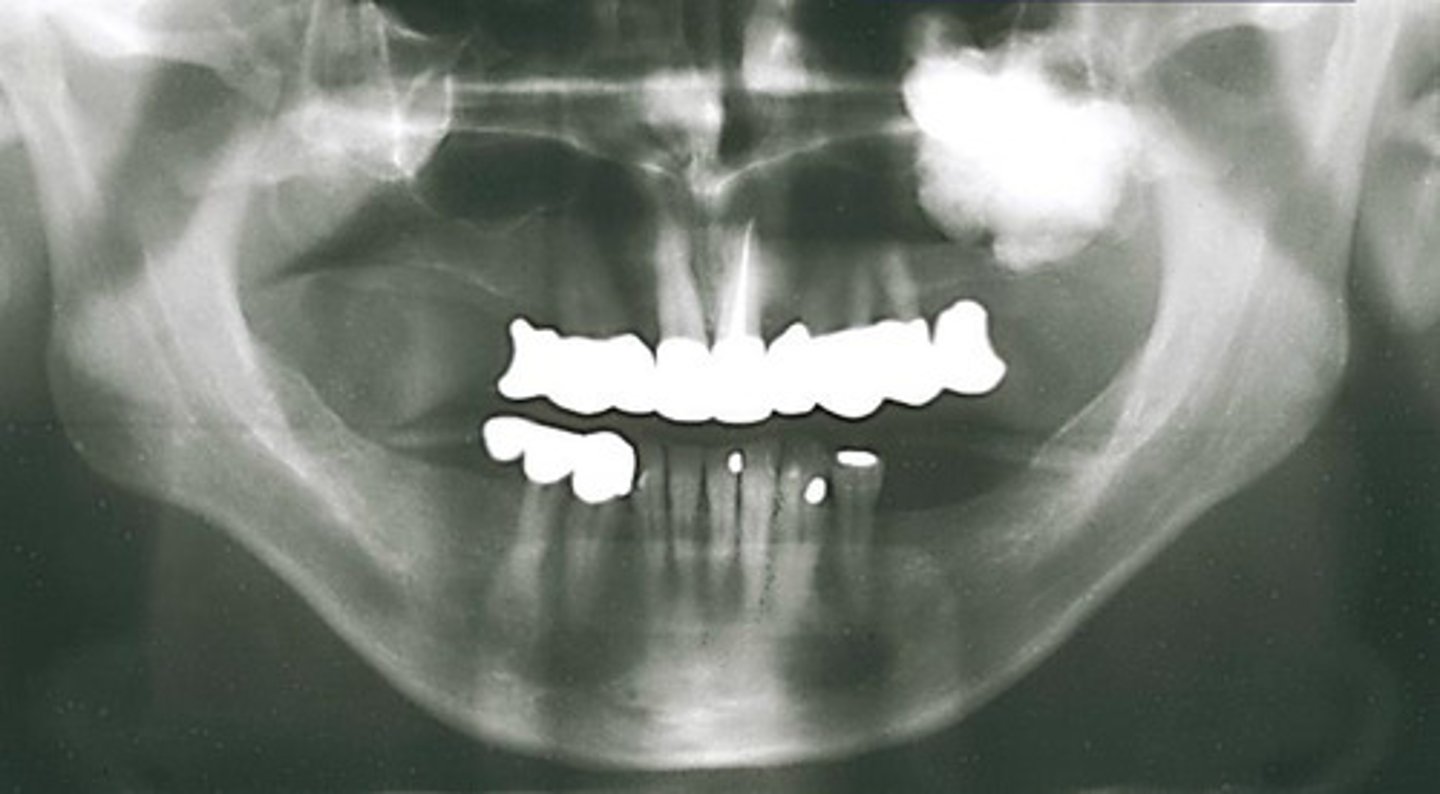<p>How would you describe the lesion?</p>