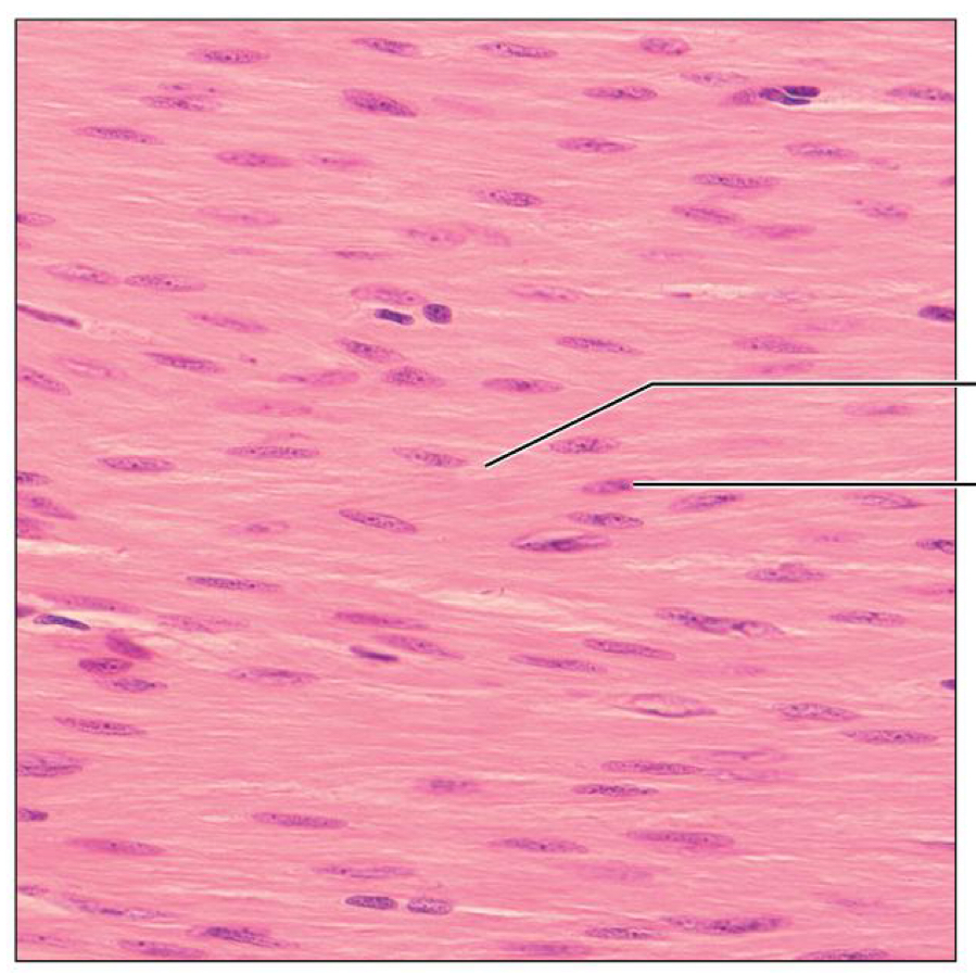 <p>What tissue is this</p>