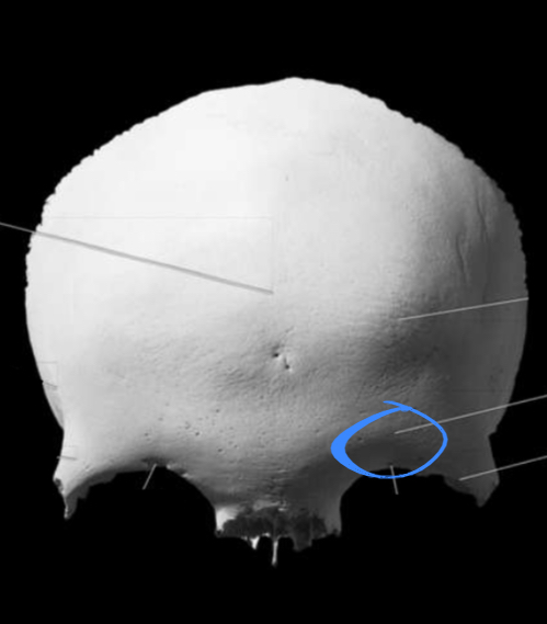 <p>Located on the frontal bone of the cranium</p>