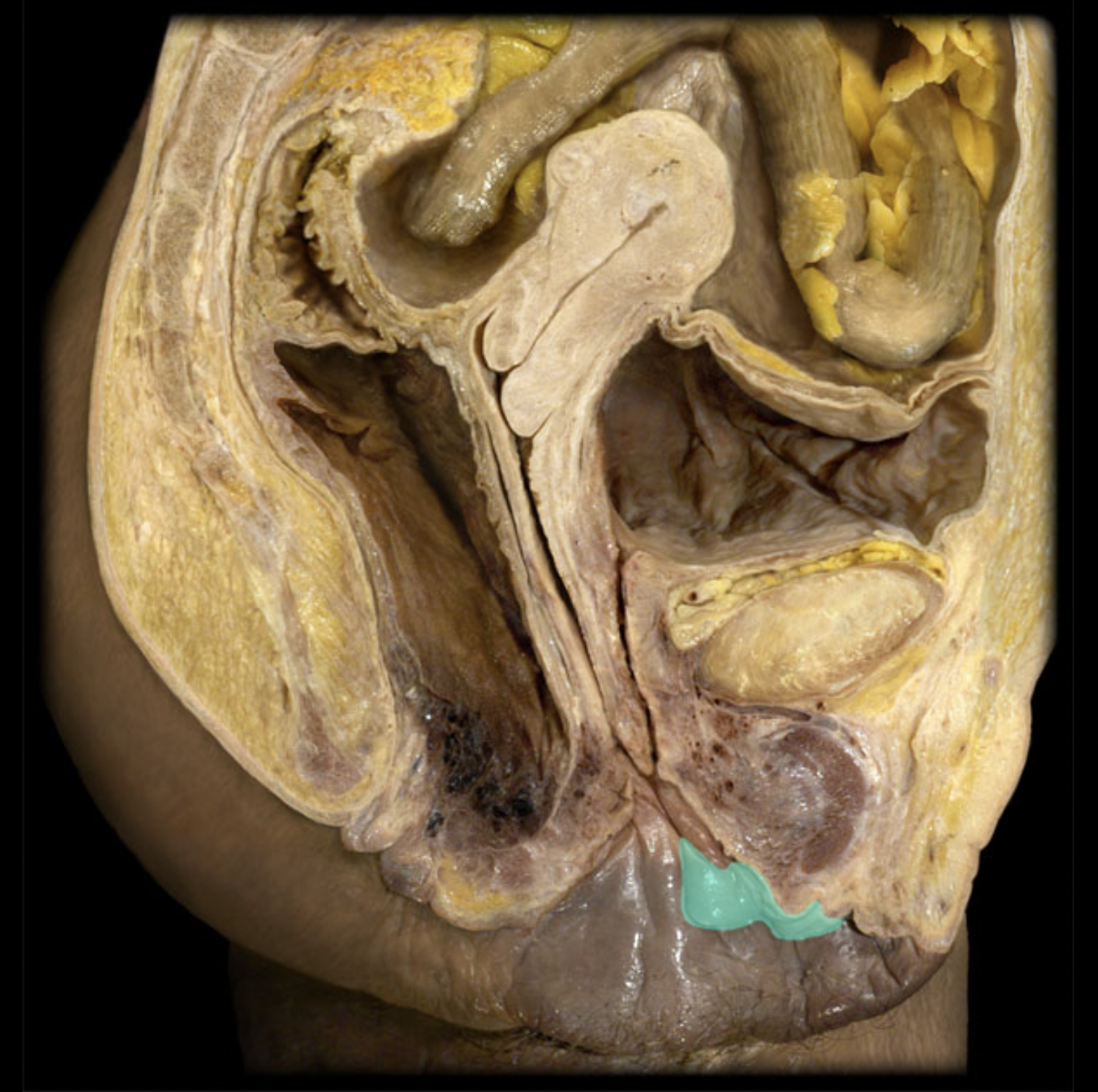 <p>What structure is shown?</p>