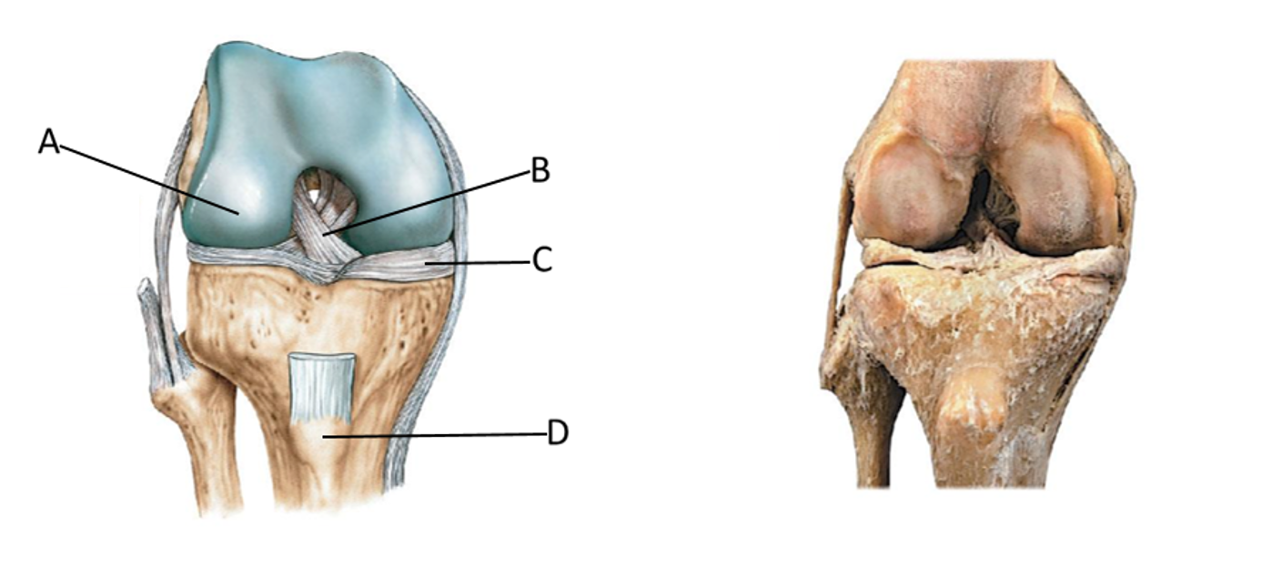 <p>lateral condyle, anterior cruciate ligament, medial menisci, patellar ligament</p>