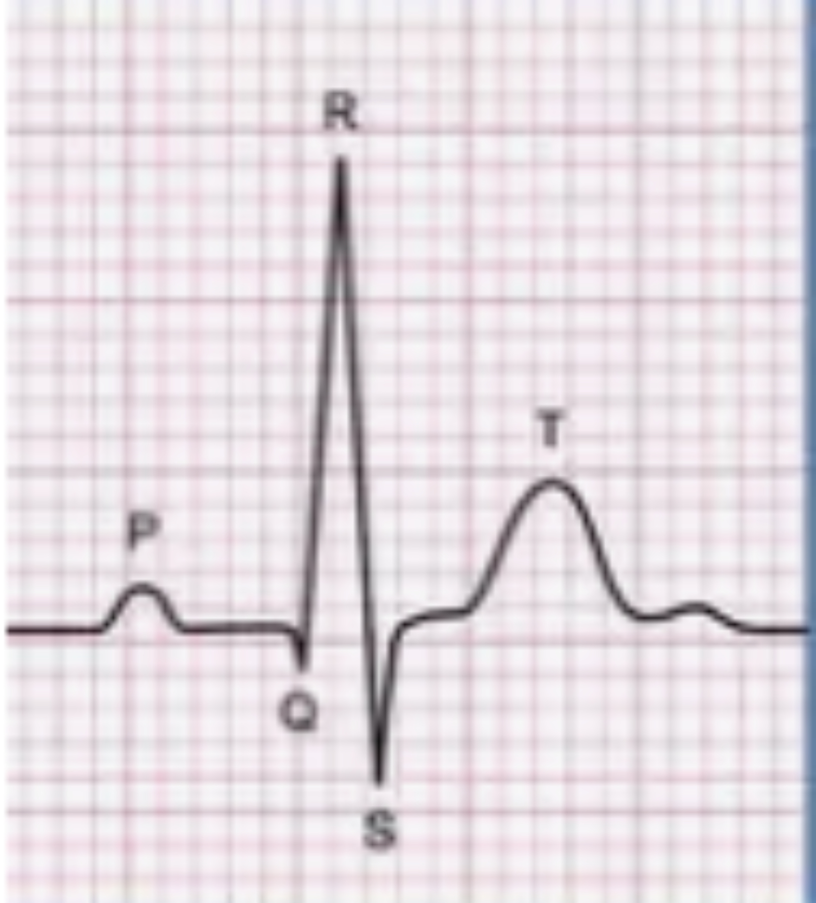 <p>What is this?</p>