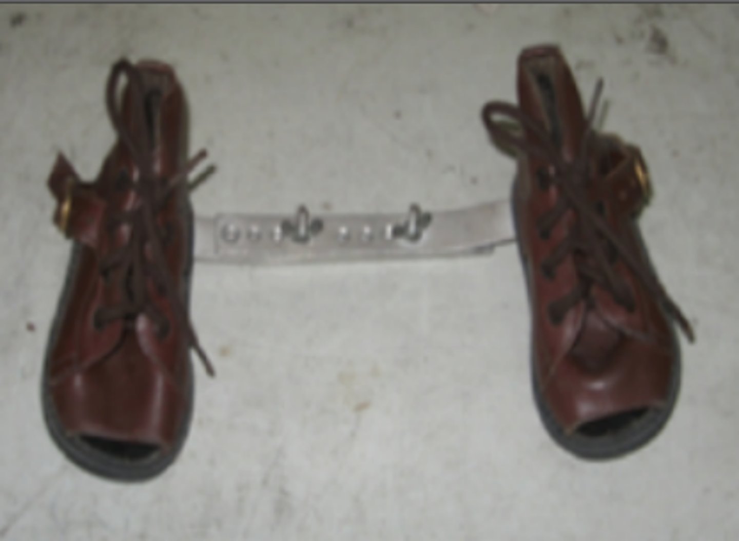 <p>For congenital clubfoot (Talipes Equino Varus)</p>