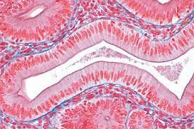 <p>a type of tissue found in the body. It consists of a single layer of tall, column-shaped cells. This type of epithelium is typically found lining the digestive tract, where it functions in absorption and secretion. It can also be found in other areas of the body, such as the respiratory tract and reproductive system. Simple columnar epithelium is characterized by its elongated shape and the presence of specialized structures, such as microvilli or cilia, on the cell surface. Overall, it plays an important role in maintaining the function and integrity of various organs and systems in the body.</p>