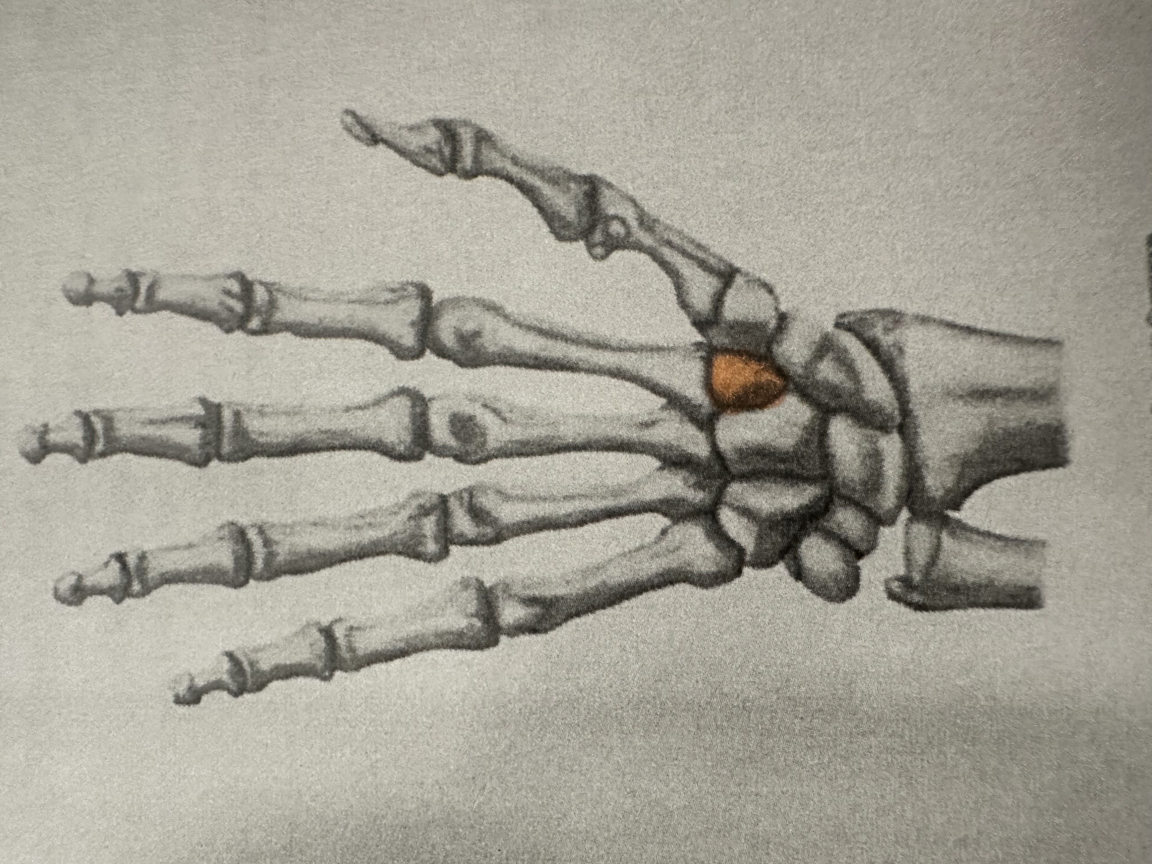 <p>Distal Carpal Bone</p><p>( Here Comes The Thumb)</p>