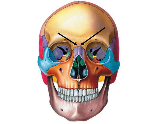 <p>Boundary between the nasal bone and the frontal bone.</p>