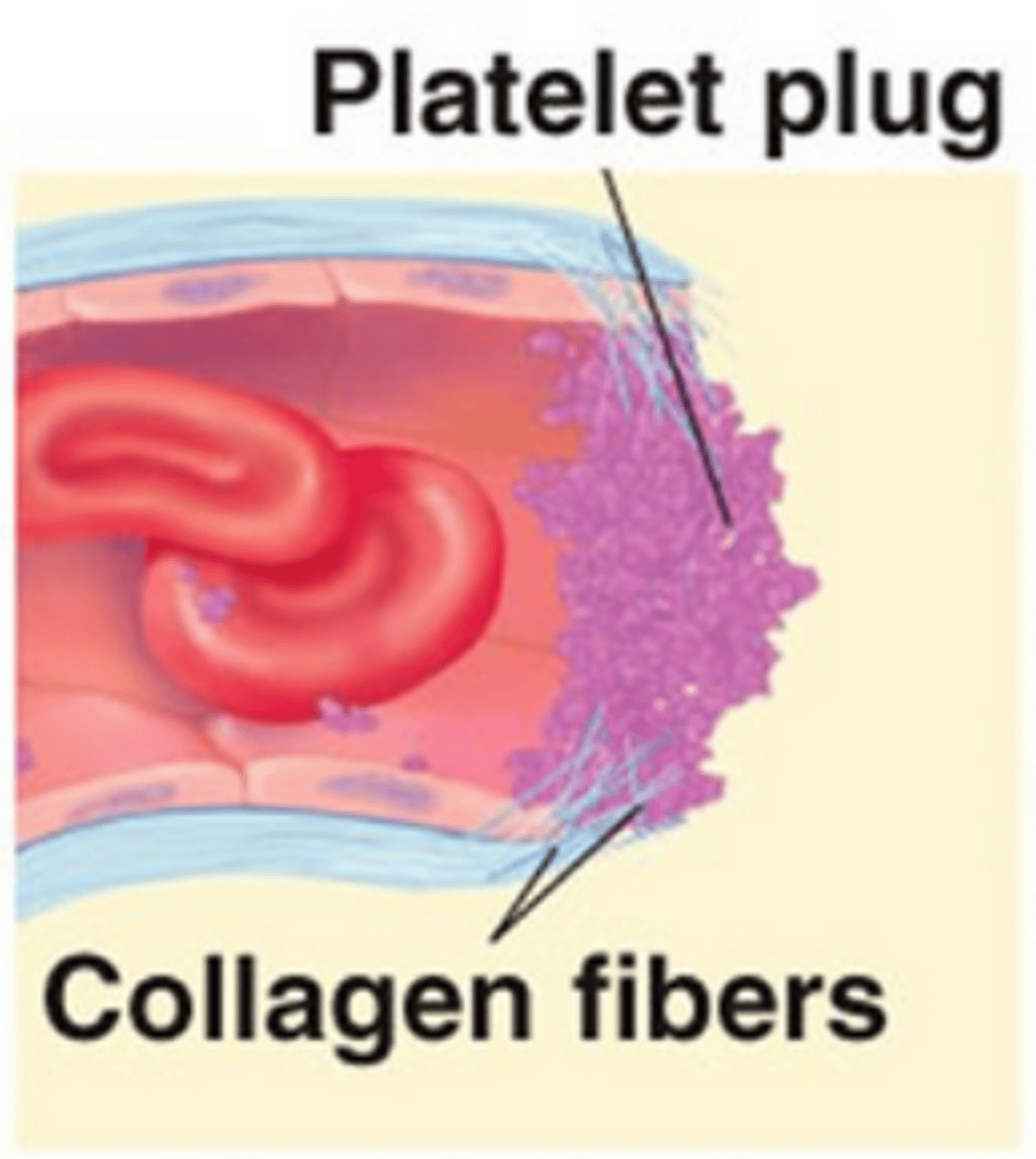<p>Collagen fibers are exposed by a break in a blood vessel<br>Platelets become "sticky" and cling to fibers<br>Anchored platelets release chemicals to attract more platelets<br>Platelets pile up to form a platelet plug</p>