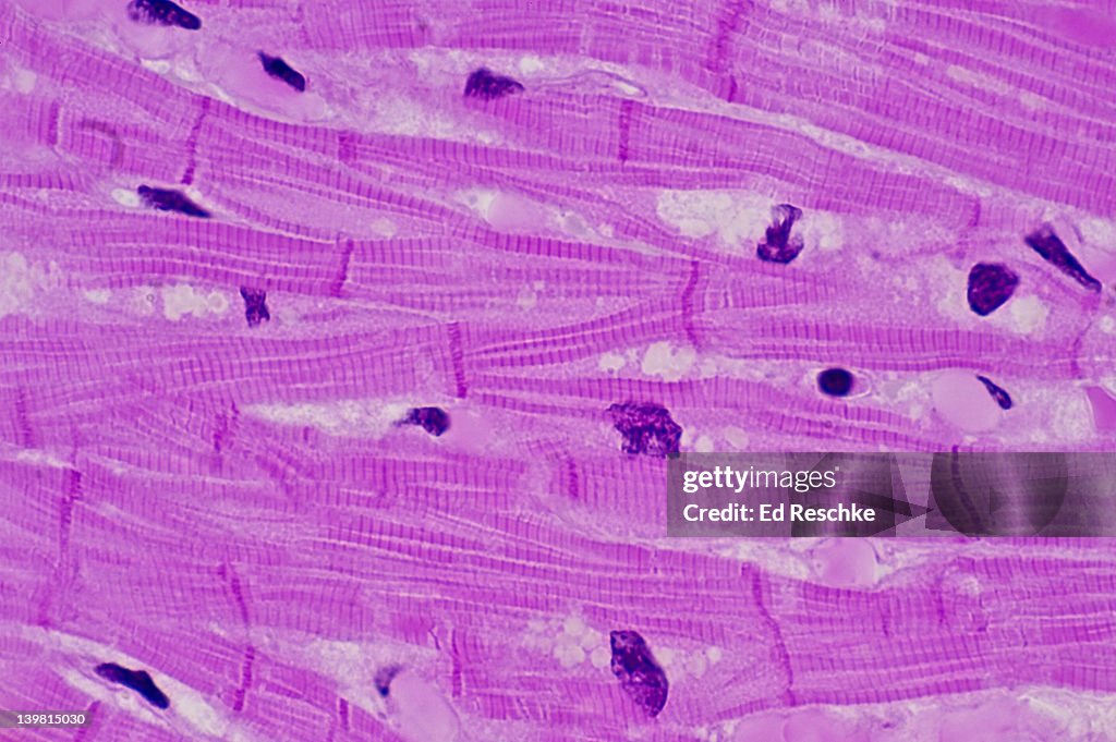 <p>Cardiac Tissue</p>