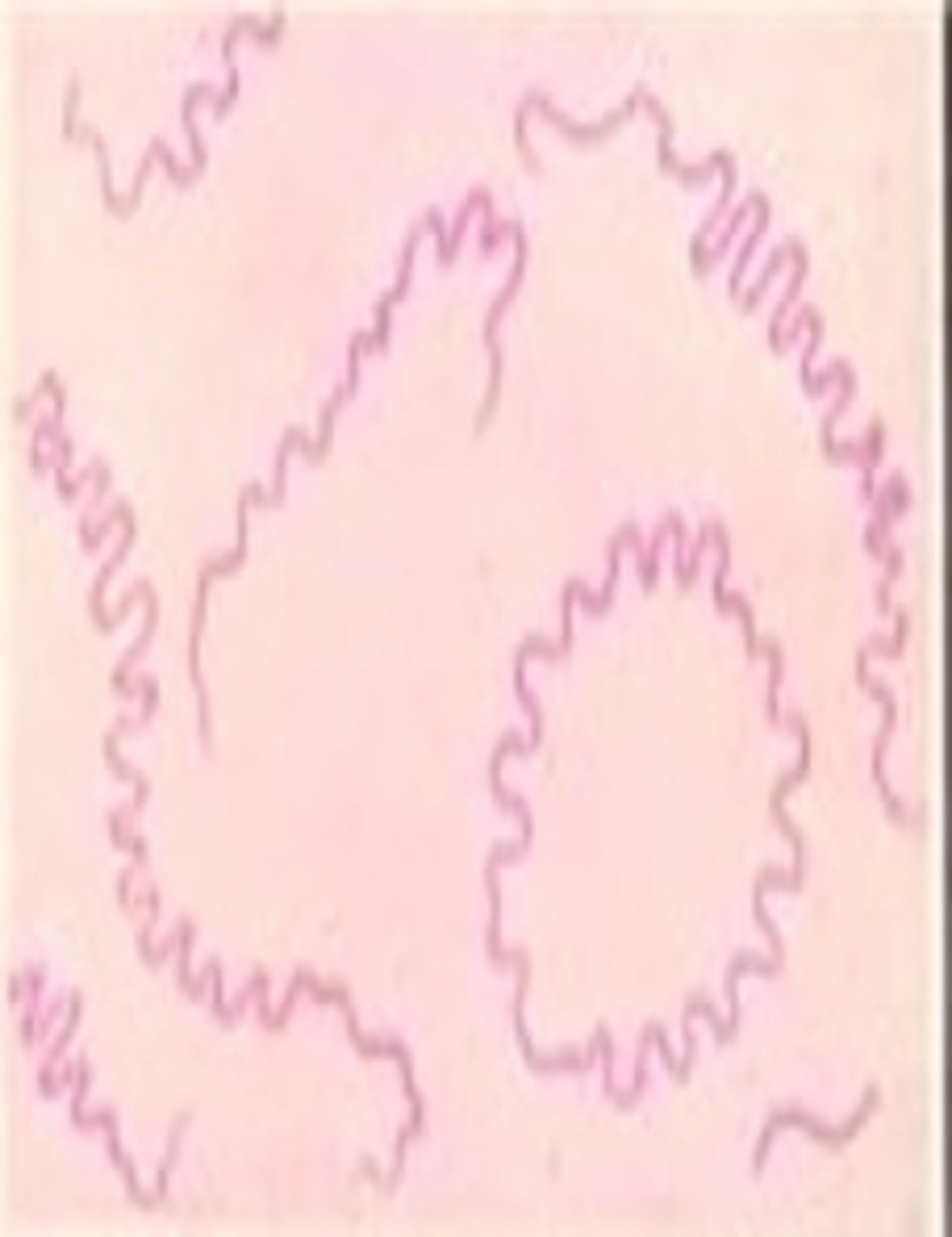 <p>Gram negative spiral</p><p>Affects the renal and hepatic systems</p><p>Causes fever, jaundice, vomiting, and kidney/liver failure</p><p>Zoonotic</p>