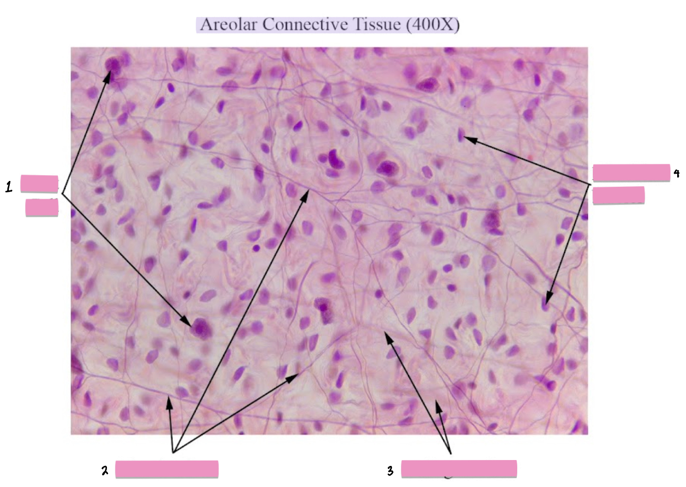 <p>(4) Areolar Connective Tissue cellular characteristics</p>