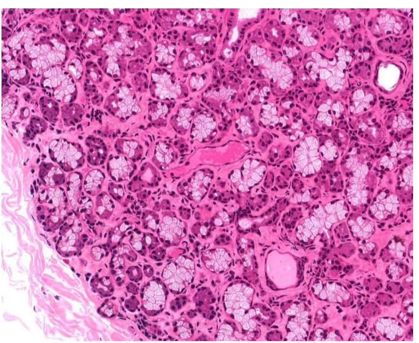 <p>what gland is this </p>