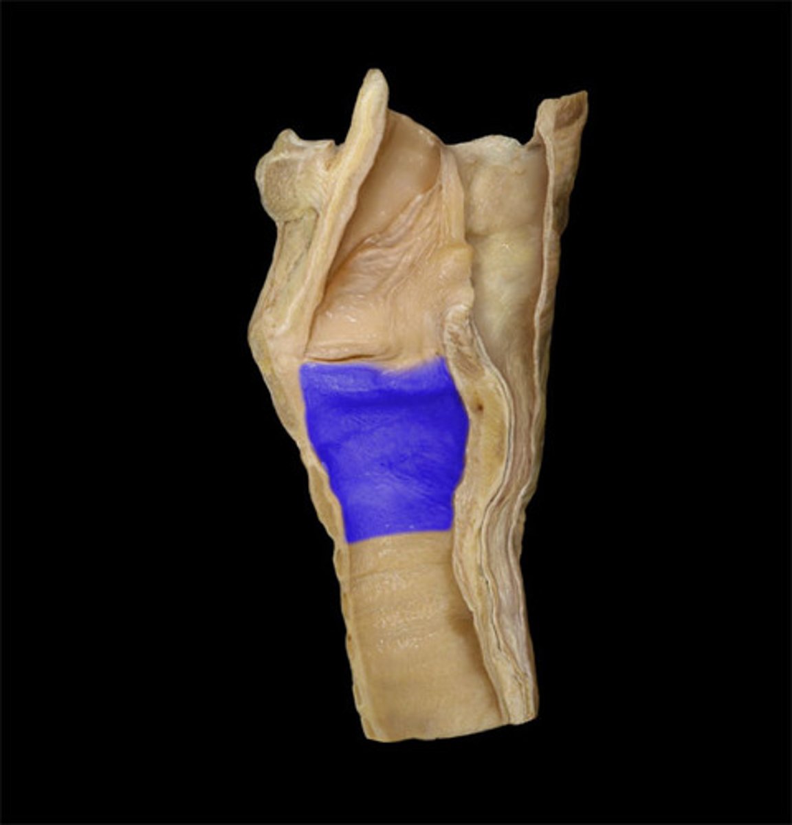 <p>space underneath vocal fold</p><ul><li><p>space</p></li></ul><p></p>