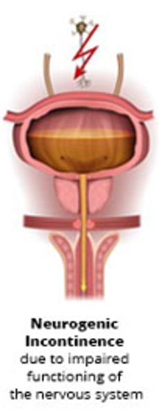 <p>random voiding/retention due to disturbed function of the nervous system<br>- common in spinal cord injuries<br>- may require catheterization</p>