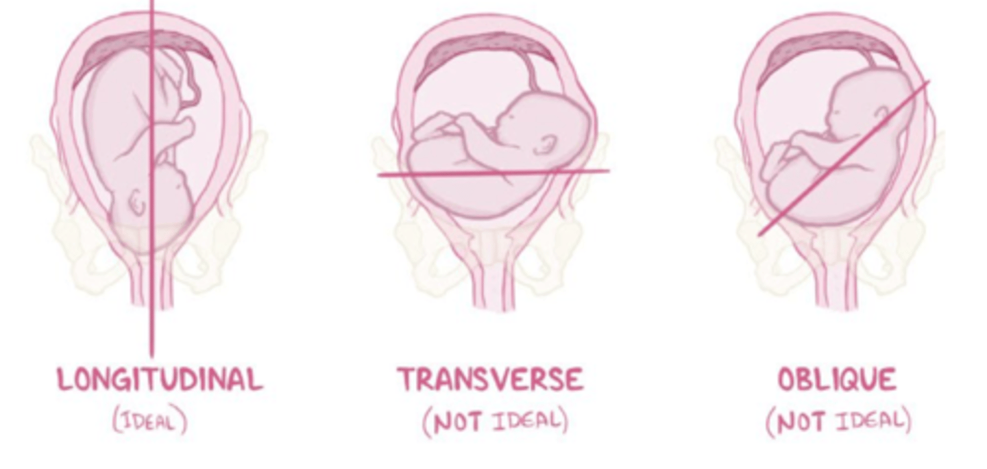 <p>-the relationship of the spine of the mother to the spine of the fetus.</p><p>-are the spines aligned?</p><p>-transverse is very rare!</p>