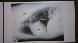 <p>Pulmonary vein and vena cava enlarged, pulmonary edema</p>