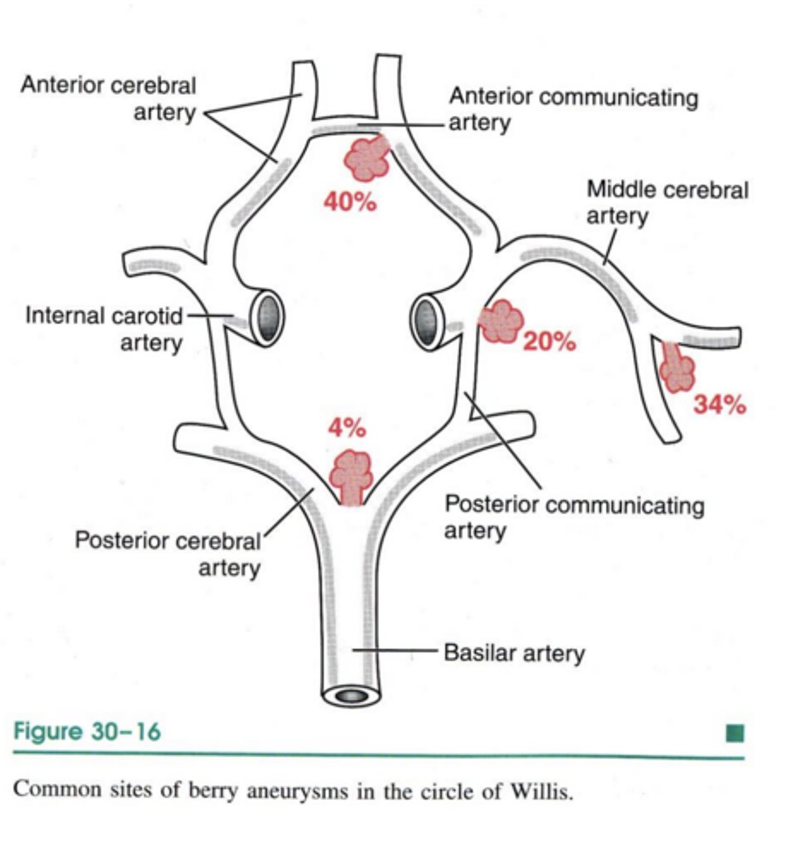 <p>non-traumatic subarachnoid hemorrhage (SAH)</p>