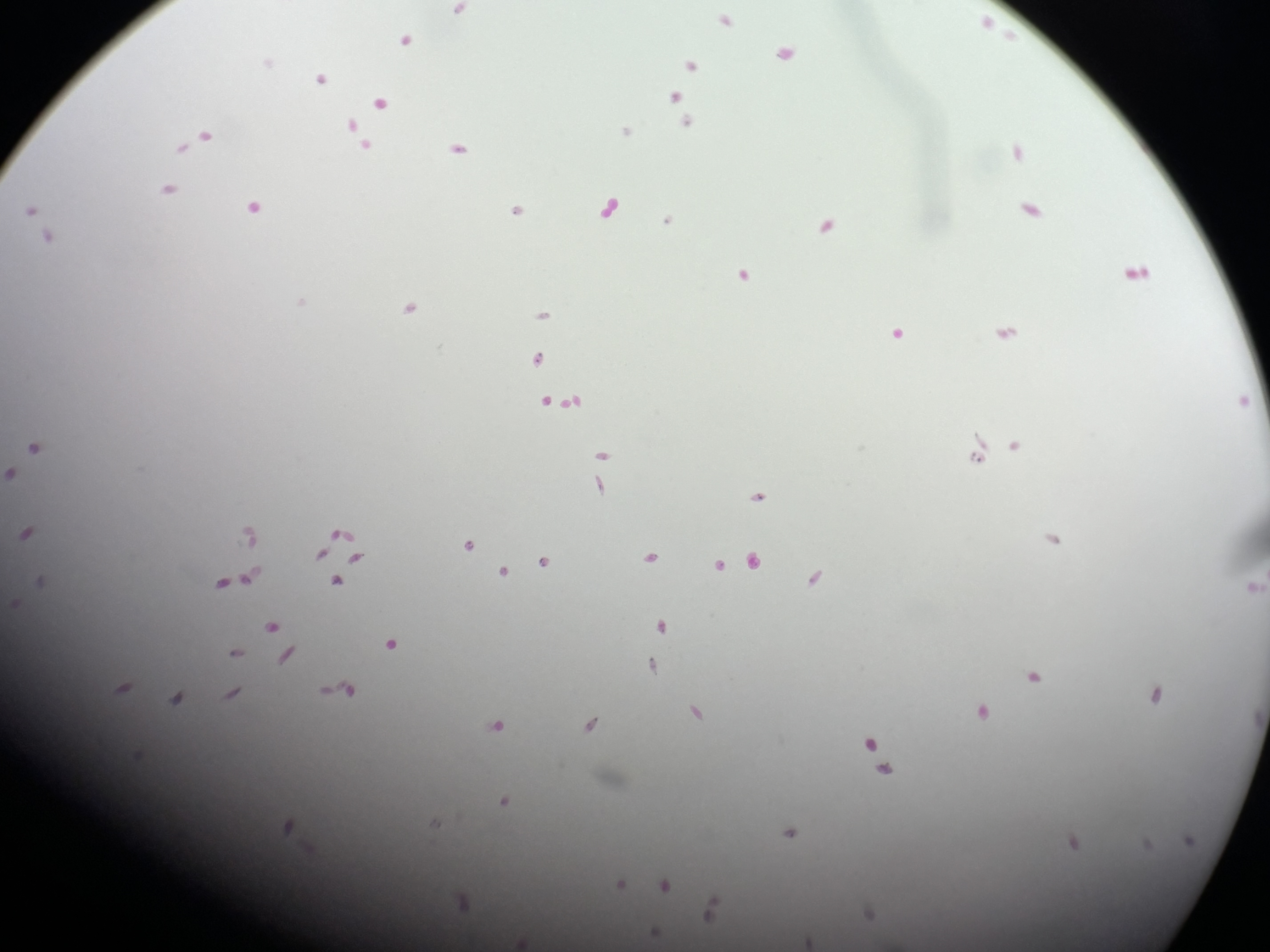 <p>Euglena</p>