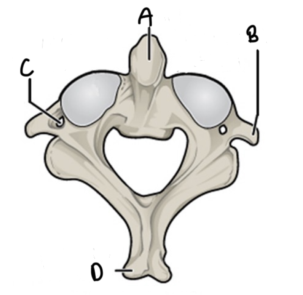 <p>What vertebrae is this and label it</p>