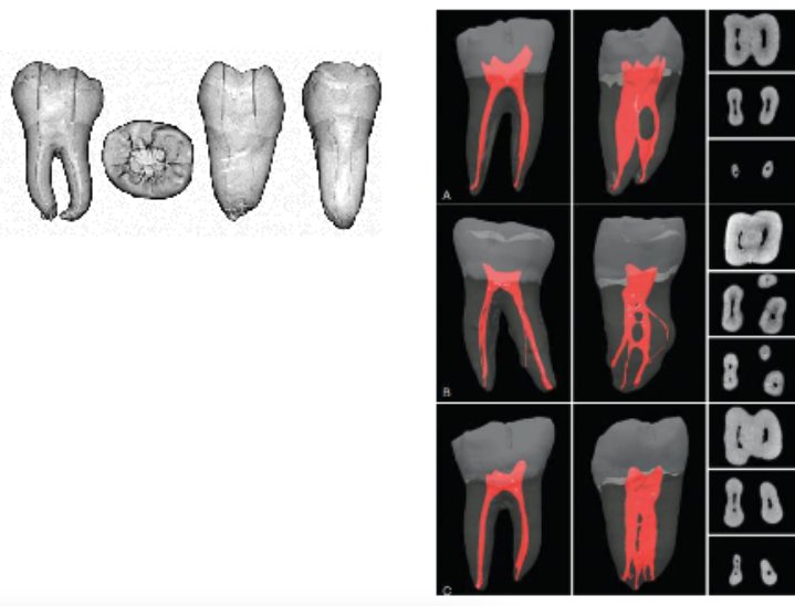 <p>approximately equal length<br>mesial root wider and stronger, distal root smaller</p>