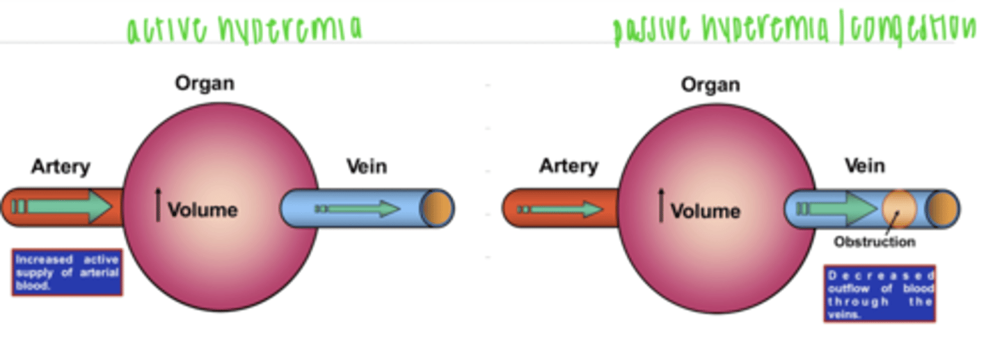 <p>the increase of blood in a specific area of the body due to a venous obstruction</p>