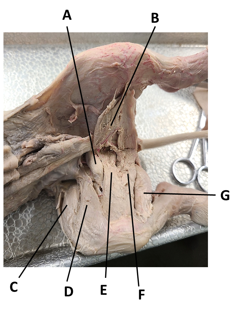 <p><span><span>Identify the muscle labeled by the letter A.</span></span></p>