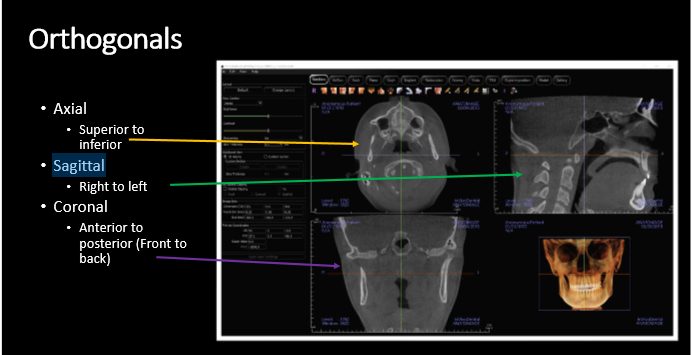 <p>medial to lateral </p>