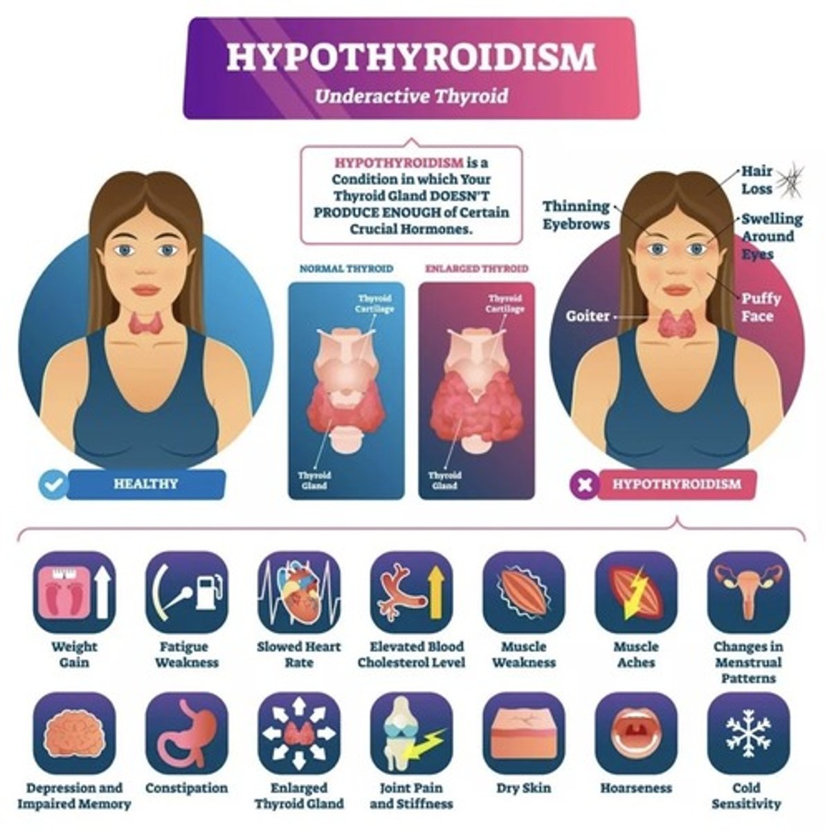 <p>Lack of thyroid hormones</p><p>Hashimoto's disease, iodine deficiency</p>