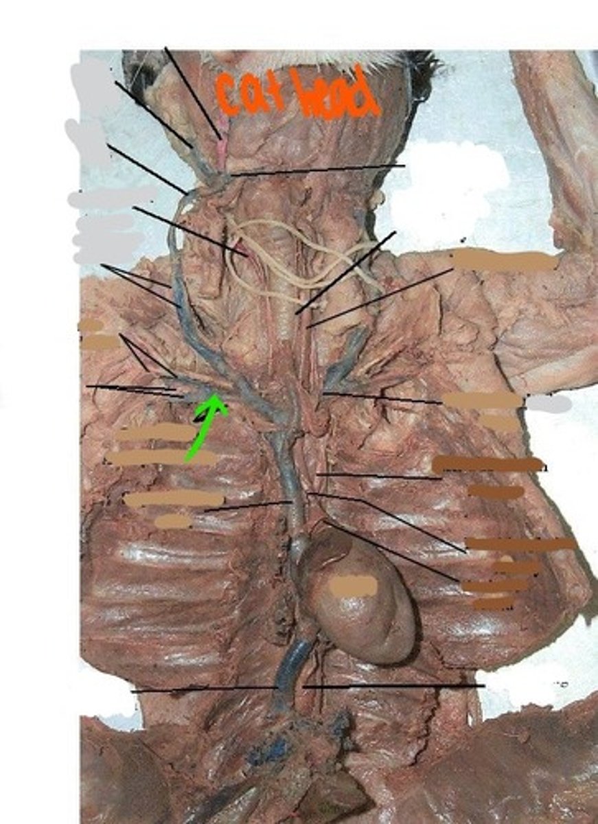 <p>identify this vein</p>