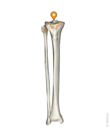 <p>Bump on the proximal surface of the Tibia that makes up the lateral side of the Intercondylar Eminence.</p>
