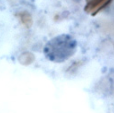 <ul><li><p style="text-align: justify;"><span style="background-color: transparent;"><span>Identify the organism. Give genus and species.</span></span></p><ul><li><p style="text-align: justify;">(1)</p></li></ul></li><li><p style="text-align: justify;"><span style="background-color: transparent;"><span>What is the morphologic stage of the organism?</span></span></p><ul><li><p style="text-align: justify;">(2)</p></li></ul></li></ul><p></p>