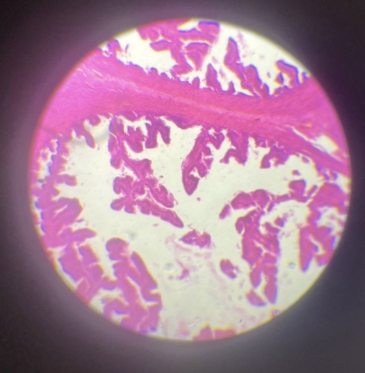 <p>Яйцепровід </p>