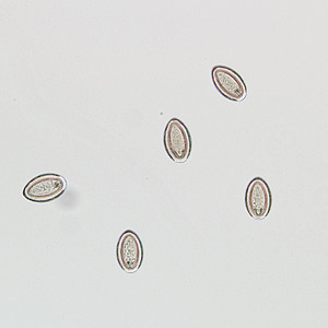 <p>Thorny headed worm eggs</p><p>Fish, aquatic birds, certain mammals</p>