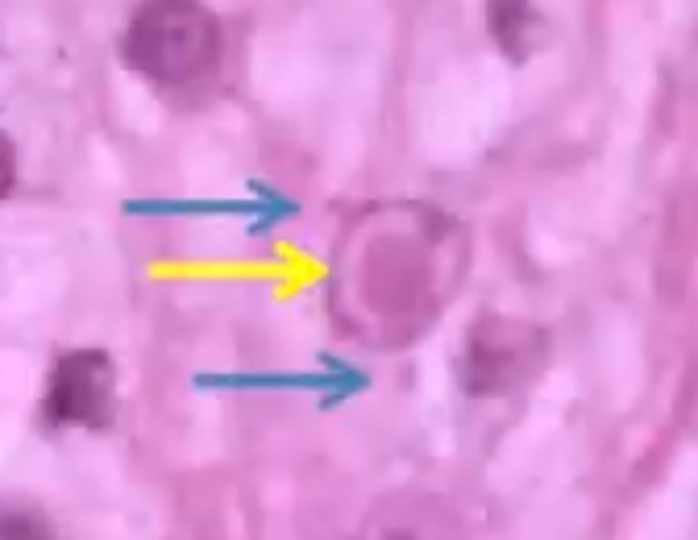 <p>Intracytoplasmic or intranuclear</p>