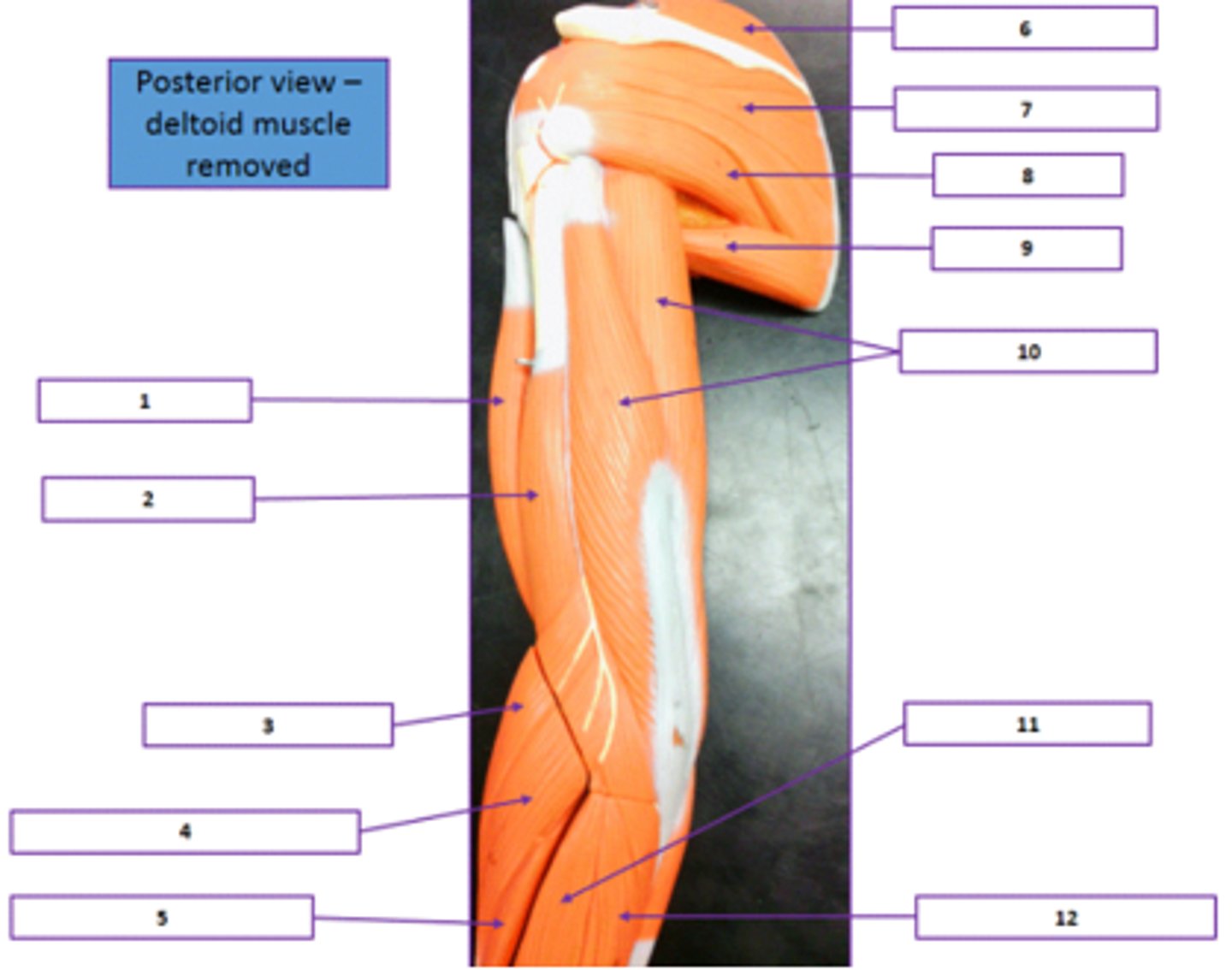 <p>Identify the muscle labeled 11.</p>