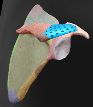 term image